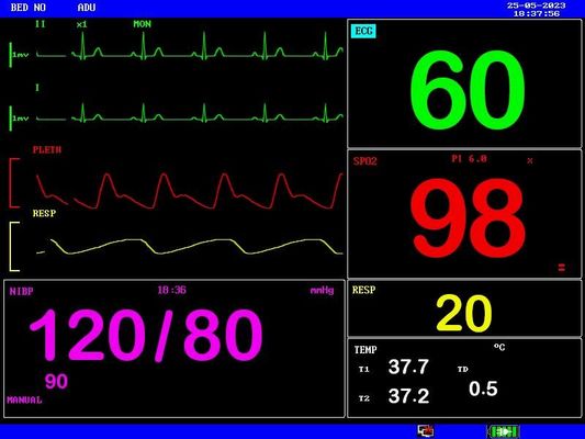 Aufladbare Batterie Portable Patient Monitor Kompakt und leicht