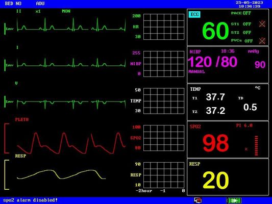 Aufladbare Batterie Portable Patient Monitor Kompakt und leicht